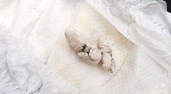 El color de las heces