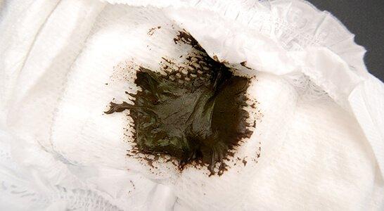 01-Negro verdoso y pegajoso D_0.jpg