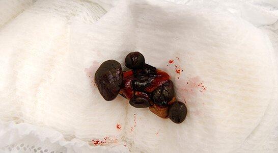 10-Con manchas rojas D.jpg