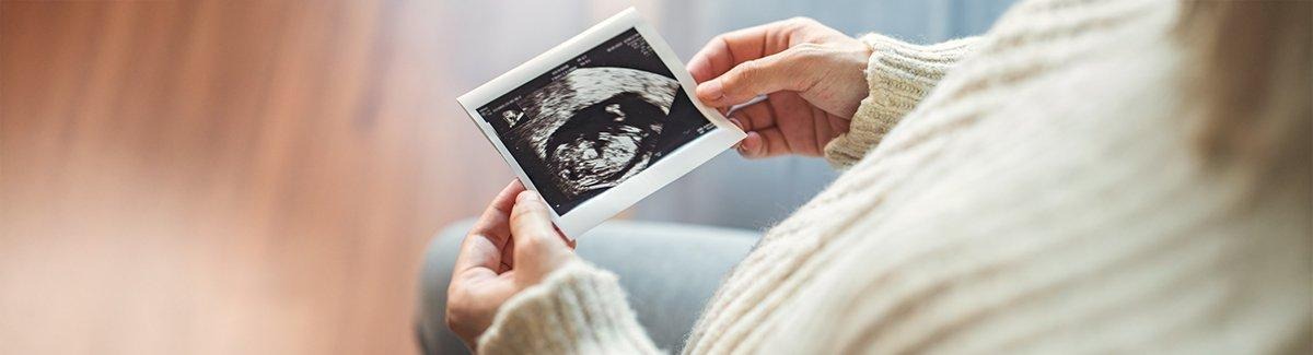 embarazo